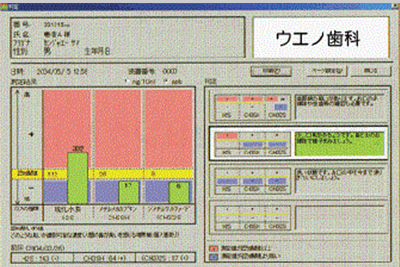 検査方法