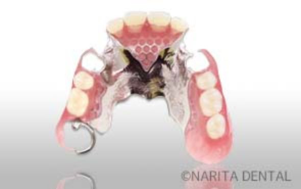 スーパーナチュラルデンチャー